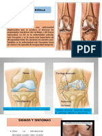 Artrosis de Rodilla: Causas, Síntomas y Tratamientos
