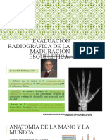 Evaluación Radiográfica de La Maduración Esquelética de Mano y Vértebras