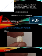 Universidad Nacional Del Altiplano Facultad de Ciencias de La Salud Escuela Profesional de Odontología Patologia Bucal Incisivo Central Superior