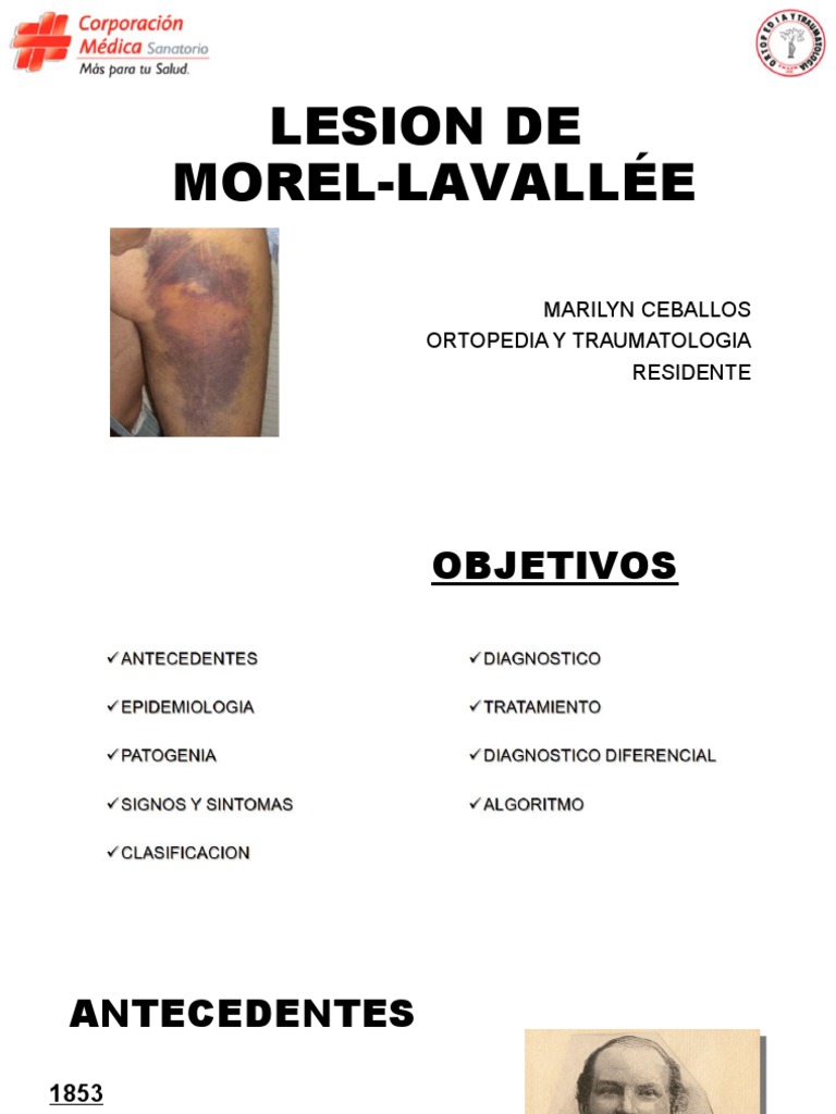 15 Lesion de Morel Lavallee PDF