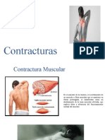 Contractura Muscular