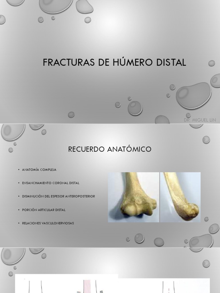 Fracturas de Húmero Distal | PDF | Codo | Lesión