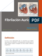 Fibrilación Auricular