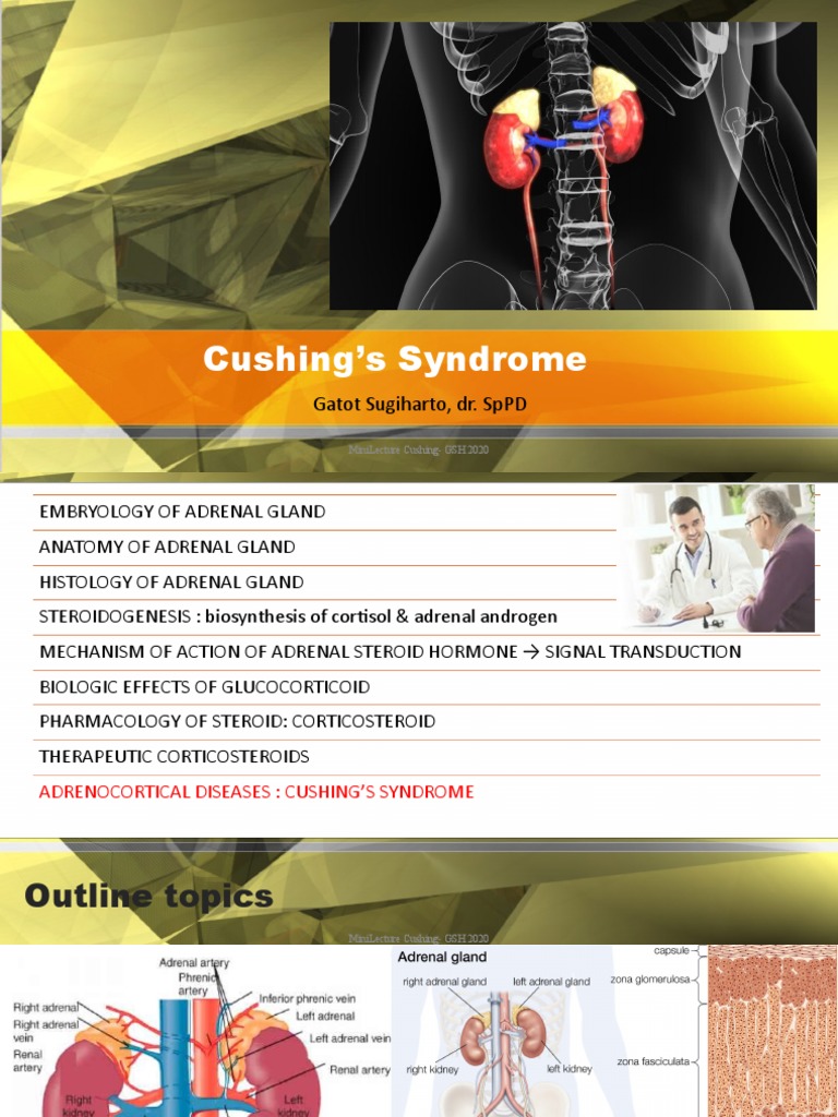 Cushing's Syndrome (Theory) PDF Adrenal Gland Glucocorticoid