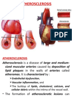 Atherosclerosis and Myocardial Infraction