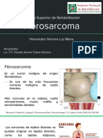 FIBROSARCOMA 