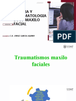 Traumatismos Maxilo Faciales