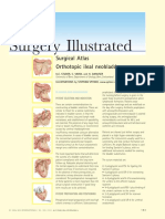 Studer Surgical - Images - of - Ileal - Conduit
