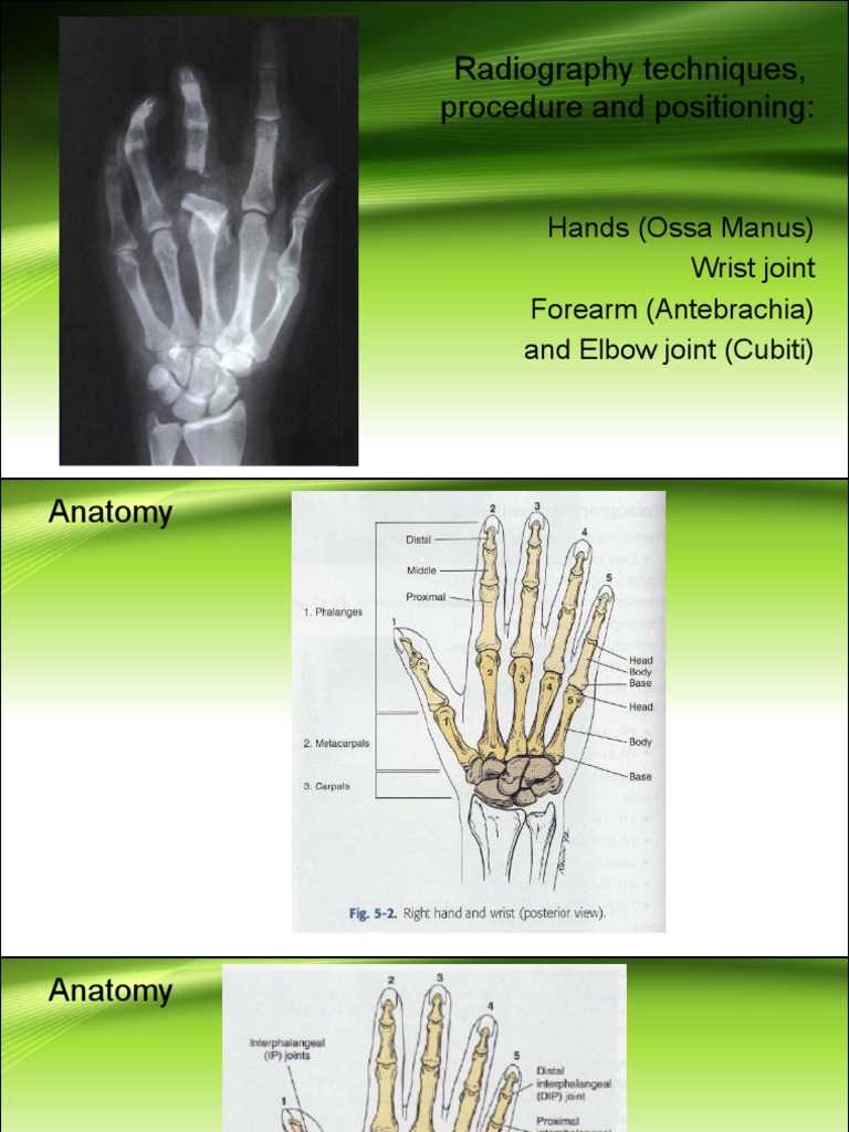 Radiography Techniques of Hands, Wrist Joint, Forearm and Elbow Joint ...