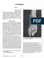 Combat Boot Palsy: Case Reports: F. Gafens