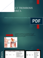 Isquemia y Trombosis