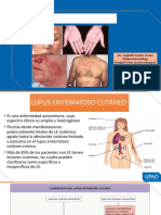 Mehu131 - U2 - T5 - Clase de Lupus, Dermatomiositis y Esclerodermia