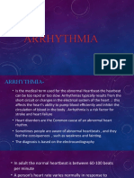 Arrhythmia