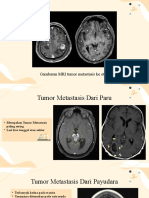 SOL - Radiologi