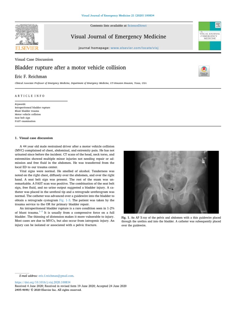Ruptur Vesica Urinaria Case Report | PDF | Urinary Bladder | Medical ...