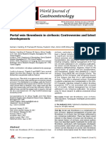 Portal Vein Thrombosis in Cirrhosis: Controversies and Latest Developments