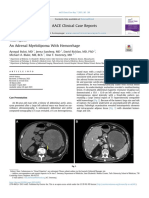 An Adrenal Myelolipoma With Hemorrhage - 2021 - AACE Clinical Case Reports