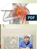 Infarto Agudo de Miocardio