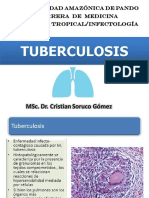 Tuberculosis Uap