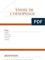 Sténose de L'oesophage