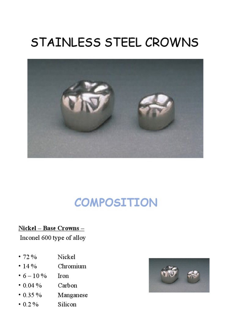 The Ultimate Guide To Stainless Steel Crowns Pros Cons Revealed - u03ir28