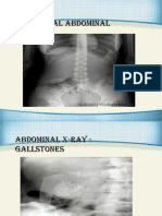 Abdomenal X Ray