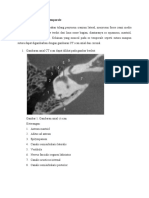 Gambaran CT Scan Os Temporale