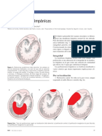 FMC Perforaciones Timpánicas