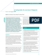 Supraventricular Tachycardia: An Overview of Diagnosis and Management