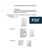 Penyusunan Gigi Anterior - Posterior Full Denture Klass Iii Skeletal