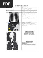 Signo de Jobert Radiológico y Clínico Pregunta Doctor Tata | PDF