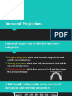 Intraoral Projections