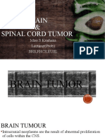 Brain & Spinal Cord Tumor: Miss.S.Krishana Lecturer (Prob) SHS, FHCS, Eusl