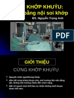 Cứng Khớp Khuỷu Điều Trị Bằng Nội Soi Khớp