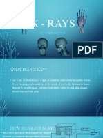 X-Ray Basics: What You Need to Know
