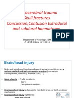 Craniocerebral Trauma Skull Fractures Concussion, Contusion Extradural and Subdural Haematoma