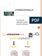 Hydrocephalus