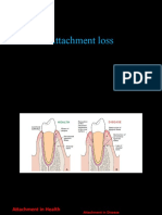 Attachment Loss