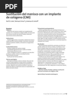 Download MENISCOPLASTIA by Jaime Orlando Gasca SN55063554 doc pdf