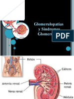 Glomerulopatias, Sindrome Nefrotico y Nefritico