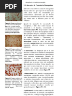 Alterações do Conteúdo da Hemoglobina