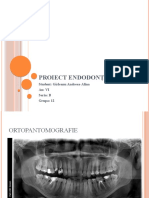 Proiect Endodonție