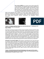 Diagnosis Banding Leukoria