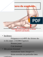 Fractures Du Scaphoïde.: DR Cousin A. Centre Lemanique de La Main Thonon Les Bains