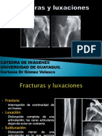 SMQ 16.1 Fracturas