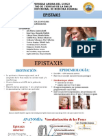 Epistaxis - Grupo 1