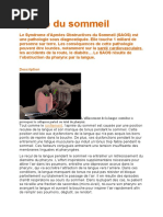 Apnée du sommeil