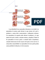 Tipos de quemaduras y sus características