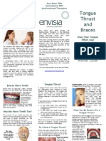 Tongue Thrust and Braces: A Question and Answer Guide
