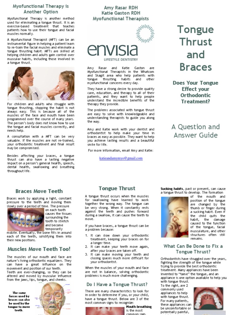 Tongue Thrust and Braces A Question and Answer Guide PDF